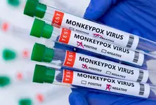 27 confirmed cases of Mpox, 1 death reported from India since 2022: WHO