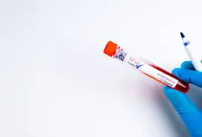 Closely monitoring monkeypox situation, no new reported cases in India: Centre