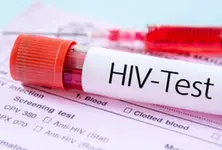 AIDS Society of India urges government to include HIV self-testing in policies