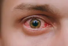 Antiviral medication may prevent vision damage associated with shingles