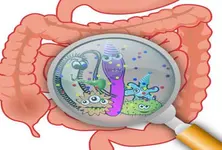 Gut microbiome changes may signal onset of rheumatoid arthritis