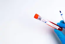 Indian researchers find new method to detect Monkeypox virus