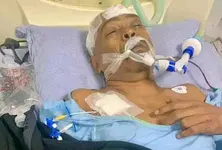 Advocate defending Hindu priest Chinmoy Krishna Das attacked in B’desh: ISKCON