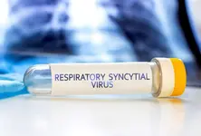 Children with chronic conditions at risk for severe RSV outcomes: Study