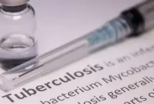 Screening for both active and dormant TB infection key to improve detection: Study