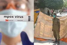 Smart lockdown enforced in Pakistan amid rising mpox cases