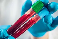 US FDA clears first-ever blood test to help diagnose Alzheimer’s disease