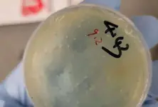 Another Chinese national arrested for smuggling ‘roundworms’ into US University of Michigan