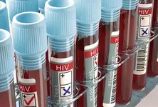 FDA approves first-ever twice-yearly vaccine to prevent HIV