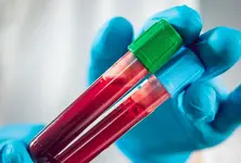 Rare discovery: French scientists discover never-before-seen blood group system