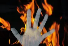 Odisha self-immolation case: Student succumbs to injuries