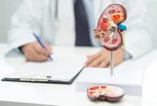 Scientists engineer gut bacteria with built-in safety switch to tackle kidney stones