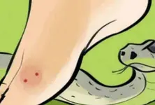 Snake sightings increase in Ahmedabad 15 to 20 daily in Vatva Narol Bopal