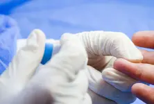 Alzheimer’s biomarker detection can now be done at home: Research