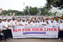 India’s youth suffering from liver damage linked to heavy energy drink consumption: Experts