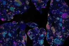 Australian study identifies early blood marker for lung cancer risk