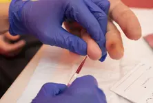 World-first fingerstick test to expand hepatitis B diagnosis access